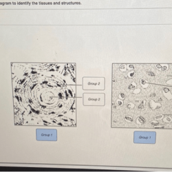 Labeling tissues epithelial columnar ciliated pseudostratified mucosa connective cilia membrane layer